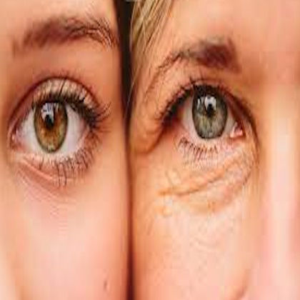 رادیکال آزاد و راه های جلوگیری از تاثیرات مخرب آن